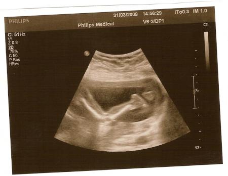 la jambe du b�b� allong� sur son ventre